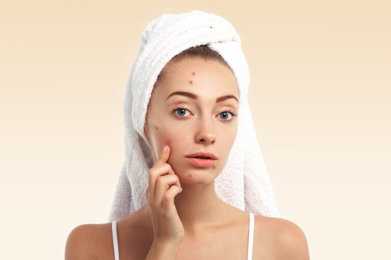 skincare untuk kulit berjerawat